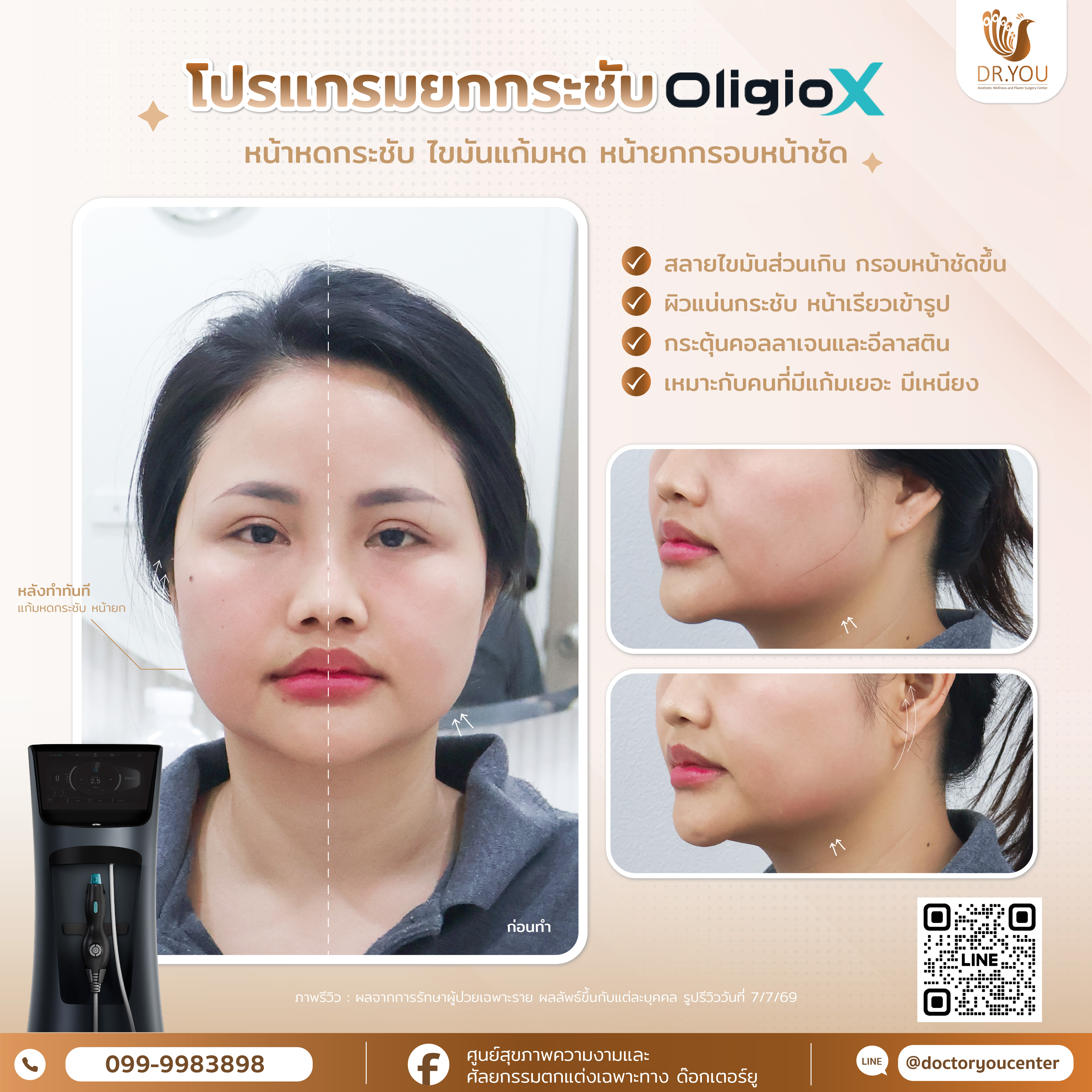 รีวิว OligioX