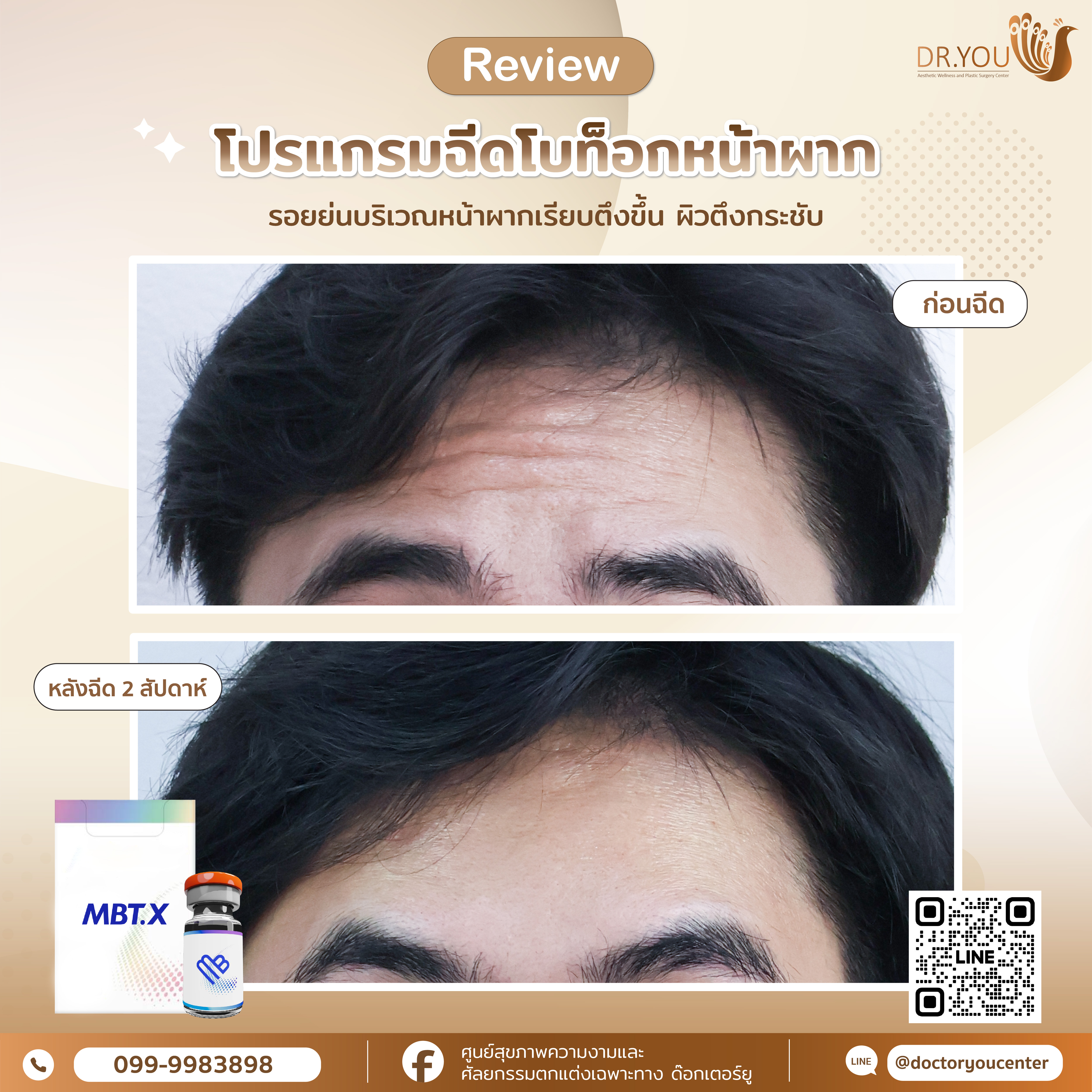 รีวิวโบท็อก