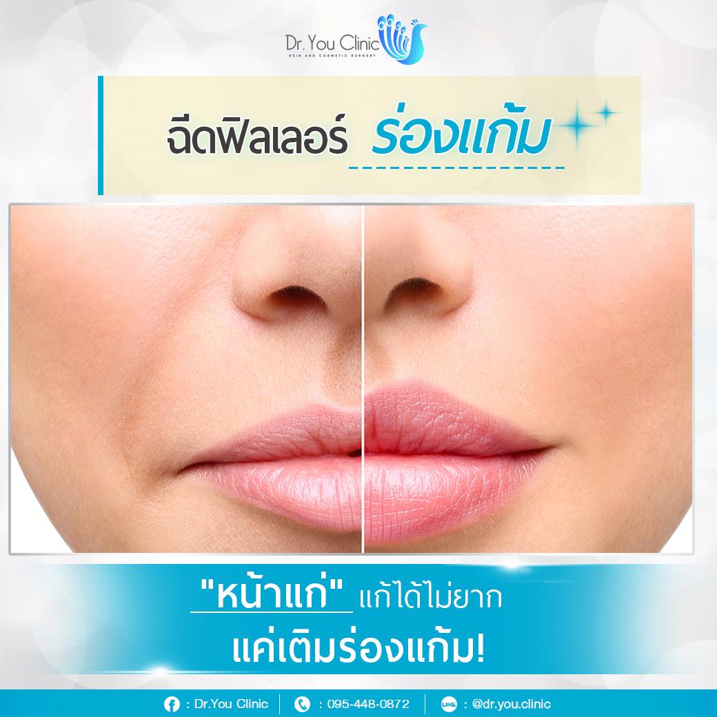 ร่องแก้มลึกเกิดจากอะไร?